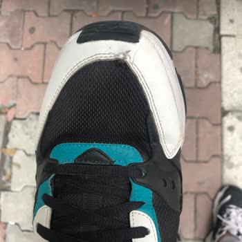 Skechers Mağduru Sıradan Bir Vatandaş!