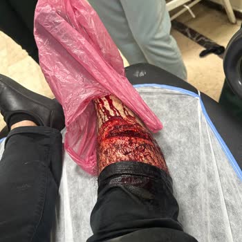 Doktor Sistem Yok Diye Acil Hastaya Bakmadı