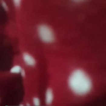 Bigolive Türkiye Hesabıma Giriş Yapamıyorum!