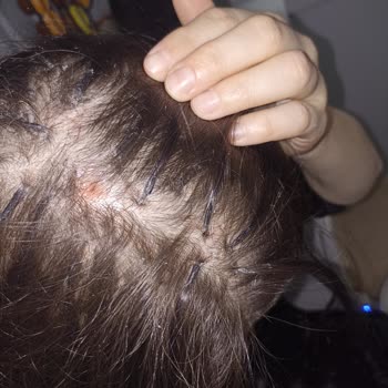 Hia Kuaför Antares Hia Kuaför, Kaynak Mağduru