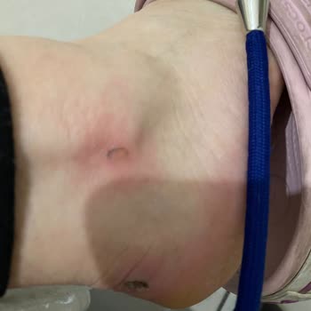 Greyder Bot Mağduriyeti- ----