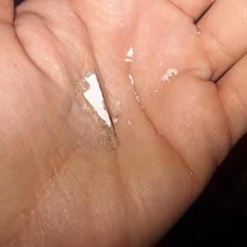 ABC Deterjan Deterjanımın İçinde Tahta Parçaları Çıktı