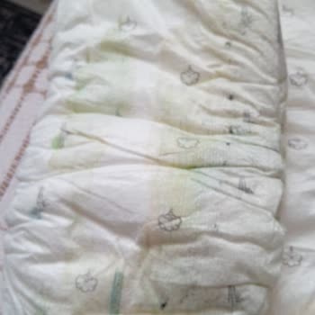 Sleepy Kalitesiz Ürün Bebek Sağlığını Tehdit Ediyor