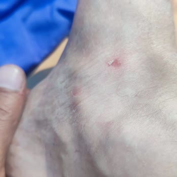 Lacoste Perakende Mağazasının Ürün Kalitesi Ve Müşteri Memnuniyeti Sorunları