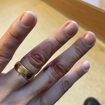 Büyükçekmece Mimar Sinan Devlet Hastanesi Kan Alma Alamadılar