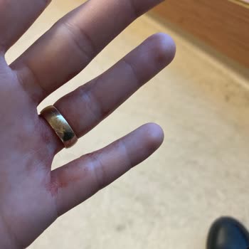 Büyükçekmece Mimar Sinan Devlet Hastanesi Kan Alma Alamadılar