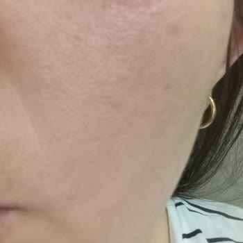 Cildimi Mahvetti Cream Co