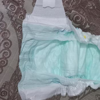Molfix Bebek Bezi Problemi