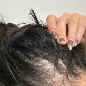 Urban Care Aşırı Saçımı Döktü