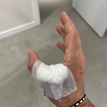 Sorunlu WMF Sürahi Başlığı Yüzünden Sürahim Elimde Kırıldı!