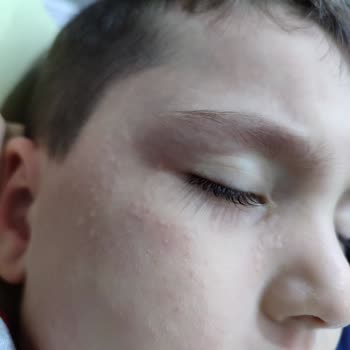 Nutrigen Multivitamin Çocuğa Yan Etki