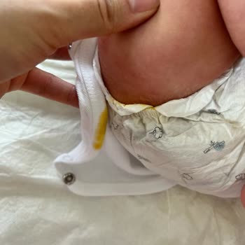 Sleepy Bebek Bezinden Taşma