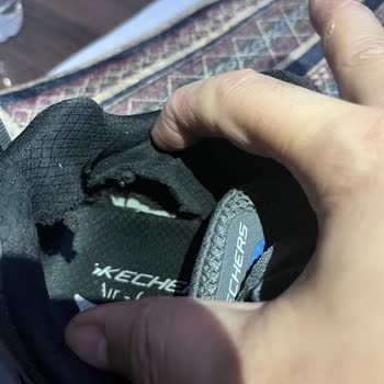 Skechers 2,5 Ayda Yırtılma Ve Kullanıcı Hatası Cevabı