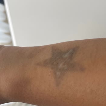 Enza Güzellik Merkezleri Sınırsız Seans Bile Alınsa, Yapılan İşlemlerden Sonuç Alınamaması