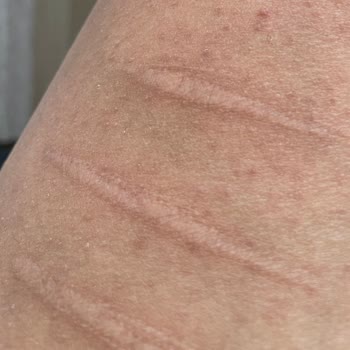 Enza Güzellik Merkezleri Sınırsız Seans Bile Alınsa, Yapılan İşlemlerden Sonuç Alınamaması