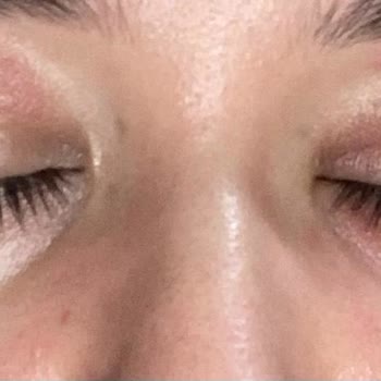 Missha BB Cream Cilt Tahrişi Yaptı