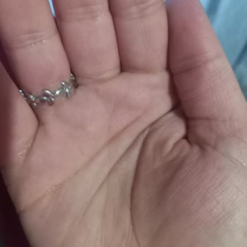 Syoss Şampuandan Mağdur Olduk