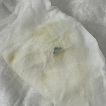 Gratis Bebek Pamuğunun İçinden Tel Çıktı!