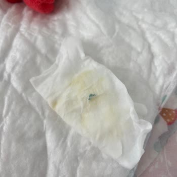 Gratis Bebek Pamuğunun İçinden Tel Çıktı!