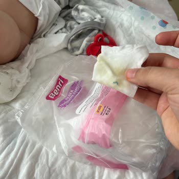 Benri Bebek Pamuğunun İçinden Tel Çıktı!