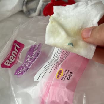 Benri Bebek Pamuğunun İçinden Tel Çıktı!