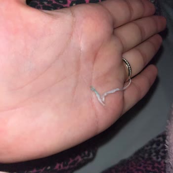 Benri Bebek Pamuğunun İçinden Tel Çıktı!