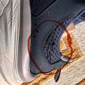 Skechers Sadece Satıyor, Sorunları Görmezden Geliyor İletişim Kurmuyor