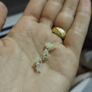 BİM Ekmeğin İçinde Tel Çıktı