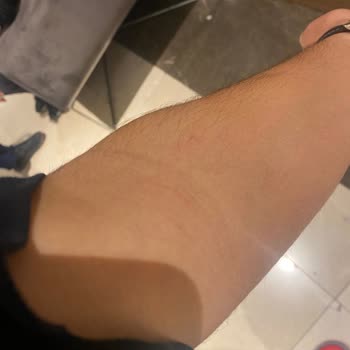 Hasta Gelip Daha Hasta Çıkışan Hastane Medical Park Mersin