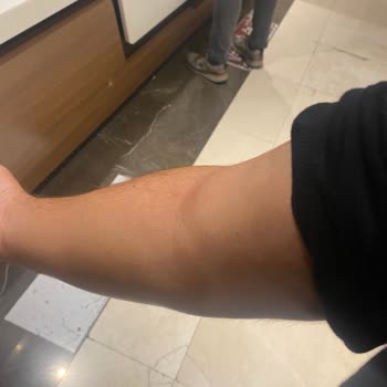 Hasta Gelip Daha Hasta Çıkışan Hastane Medical Park Mersin