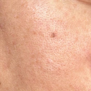 Annabella Güzellik Merkezi Annabella Tekirdağ İnsanları Mağdur Ediyor.