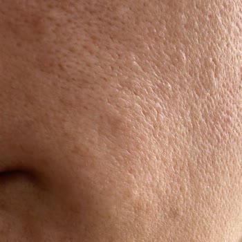 Annabella Güzellik Merkezi Annabella Tekirdağ İnsanları Mağdur Ediyor.