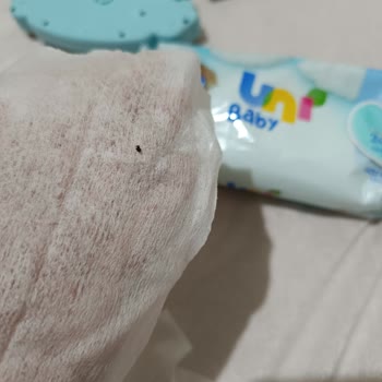 Uni Baby Islak Mendilinin İçinden Böcek Çıktı!