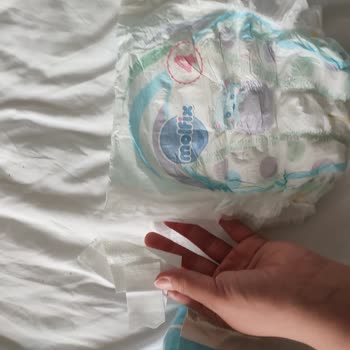 Molfix Bez Kenar Bantların Kopması