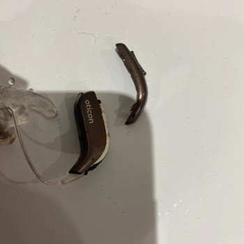 Oticon Ankara Servisinin Hatası Ve Vurdum Duymazlığı