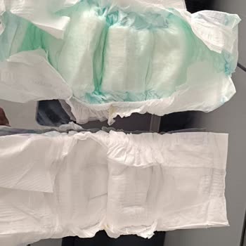 Molfix Bebek Bezi Sızdırıyor