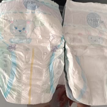 Molfix Bebek Bezi Sızdırıyor