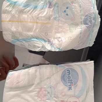 Molfix Bebek Bezi Sızdırıyor