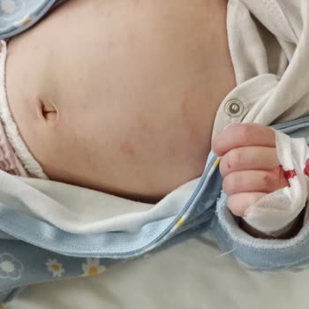 Bebelac Gold Mama Alerjisi