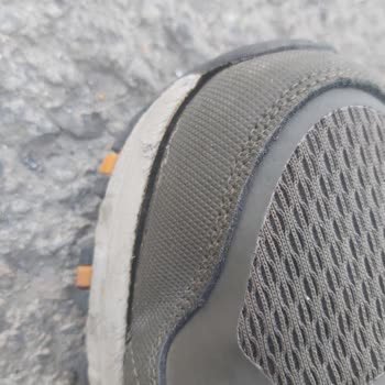 Skechers Spor Ayakkabısı Sorunu