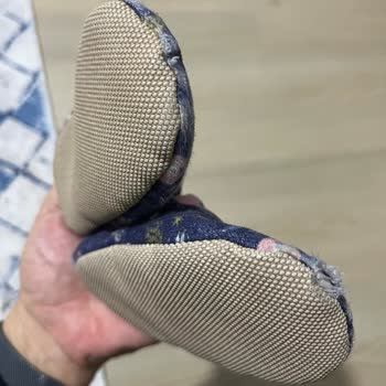 Ella Bonna Bebek Patiğinin Kısa Sürede Deforme Olması