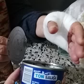Derya Ton Balığı Konserve Kapağı Elde Derin Kesiğe Sebep Oldu