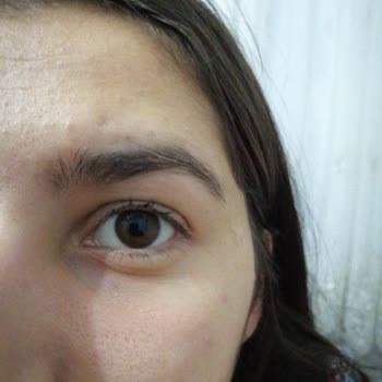 Aymira Koçaklı Yaşam Merkezi Aymira Koçaklı Bursa Hayal Kırıklığı Kirpik Lifting