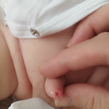 Tarsus Devlet Hastanesi Çocuk Cerrahisinde Yaşanan Sorunlar