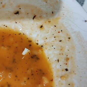 A101 Çorbada Çıkan Şeyler