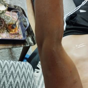 Bioder Krem Cildimi Yaktı