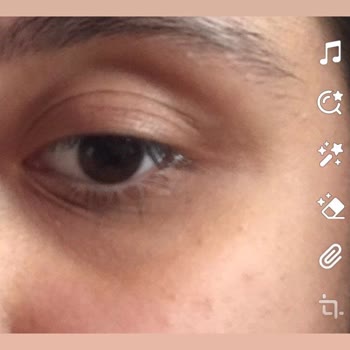 Gratis Beaulis Kapatıcı Yüzümü Mahvetti