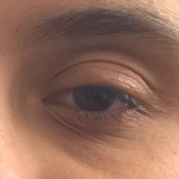 Gratis Beaulis Kapatıcı Yüzümü Mahvetti