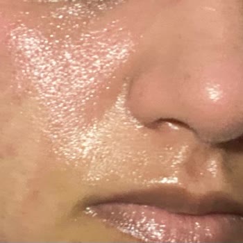 Yves Rocher Yağlı Ciltler İçin Aldığım Yüz Yıkama Jeli Şişti Ve Kızarttı