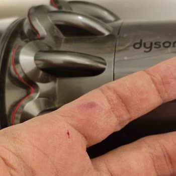 Dyson V10 Süpürge Elime Fiziksel Zarar Verdi
